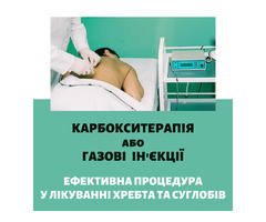 Карбокситерапія або газові уколи - сучасний метод лікування! | ogoloshennya.com.ua - 1